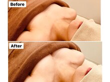 アンシャンテ(ENCHANTER)/光バストアップ