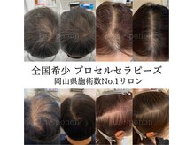 ラポノンプラス(La ponon+)の雰囲気（プロセル頭皮トリートメント）