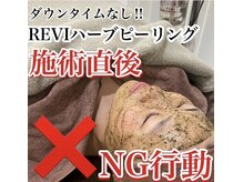 ホワイトアクア 梅田本店(WHITE AQUA)/ハーブピーリング/大阪/梅田