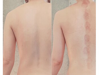 サプナジー(Suppnrgy)/カスタムトリートメント