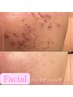 【話題のハーブピーリング】100％ミネラルハーブで肌質改善!感動美肌を実感☆