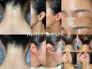ホテルアンドパーク(HOTEL&PARK.)