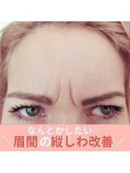 ハリファ鍼灸院 横浜関内院(HariFa鍼灸院)/眉間のケア