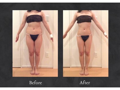 ハイミー(Heimy)の写真