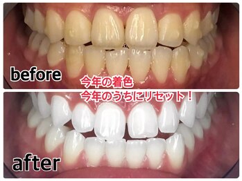 ホワイトニングビューティー 東陽町