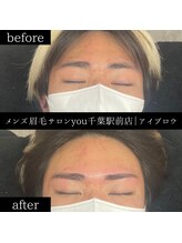 ユー 千葉駅前店(you)/ビフォ－アフター写真