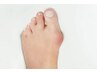 足トラブル(指の変形/タコ/魚の目)を改善へ導く足カウンセリング ¥0