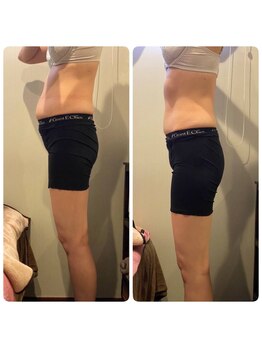 アリュール 小島本店(Allure)/