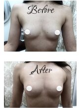 アルストロメリア(Alstroemeria)/光バスト～ふっくらハリアップ！