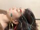 やす鍼灸院の写真/【美容鍼でむくみ×たるみケア☆】電気美容鍼で表情筋を引き上げ横顔美人♪また身体の不調にも鍼が最適!!