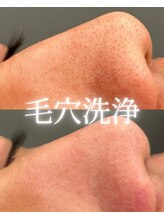 カリス(Charis)/毛穴洗浄