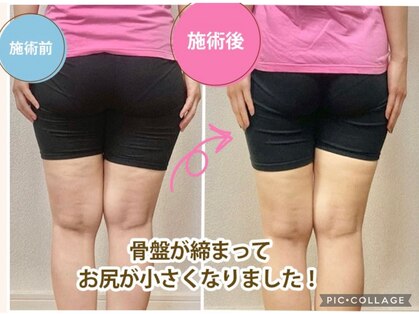 骨盤整体 サクラ(Sakura)の写真