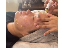 アイビー(ivy)/最先端マイクロニードル