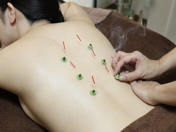 ティルナノーグイリニ(Tir Na Nog-EIRINI)/巡りを整える整える施術