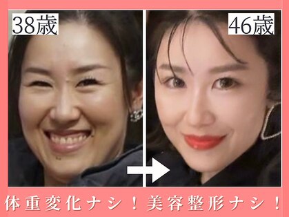 エソア(esoa)の写真