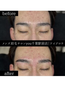 ユー 千葉駅前店(you)/ビフォ－アフター写真