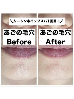 ポワールムース(POIRE mousse)/Before&After写真☆