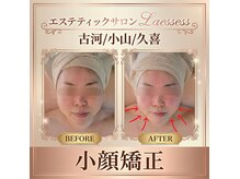 ラエッセス(A Laessess)