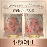 ラエッセス(A Laessess)