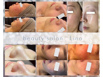リノ(Lino)の写真