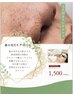 【小鼻の毛穴洗浄♪】炭酸ピーリング＋光フォト　¥1,500