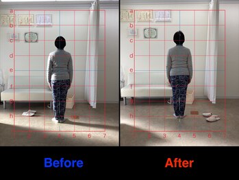 整体院 仁(JIN)/#ヘッドマッサージ#ヘッド#首痛