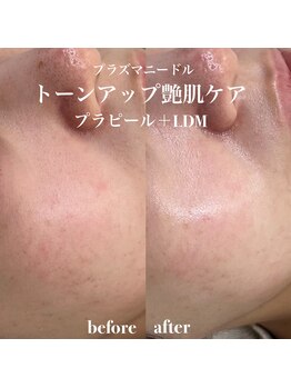 イロハ(IROHA)/トーンアップ艶肌ケア!