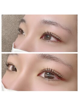 キャンディベース ドライブイン(Candybase Drive in)/ラッシュリフト