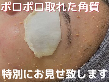 グレース 吉祥寺(grace)/【毛穴/ヘッドスパ/脱毛】