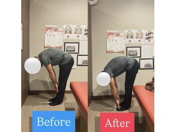 ナオル整体 宮崎院(NAORU整体)/50代男性施術事例【腰痛改善】
