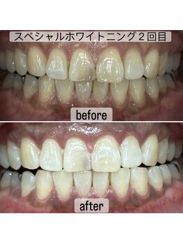 ヤット 森ノ宮(yatto.)/50代女性