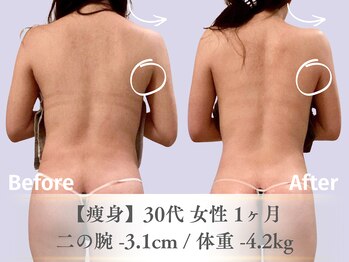 ベルペール(Belle perle)/【痩身】ハンドセラピス