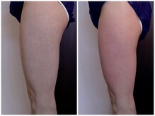 イーリバイブ/iNVYDOM MAX