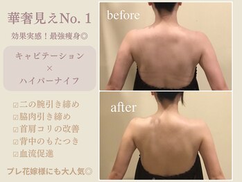 エステティックサロン アールグレー 名古屋駅店/プレ花嫁様/1ヶ月集中◎6回変化