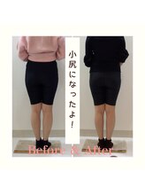 スタイルラボ高松/産後の骨盤矯正の効果♪