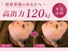 【横顔すっきり】首元までしっかり｜マイクロウェーブ全顔+顎下+首元120kj