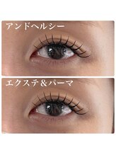 リノ(LINO)/アンドヘルシー140本