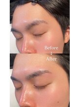 眉毛男子 新宿店/Before/After