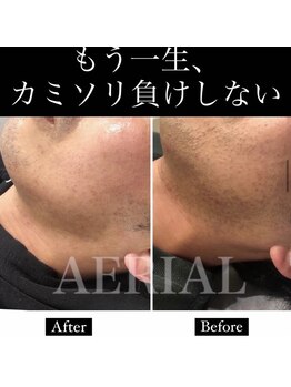 エアリアル 大牟田店/カミソリ負けしない肌へ