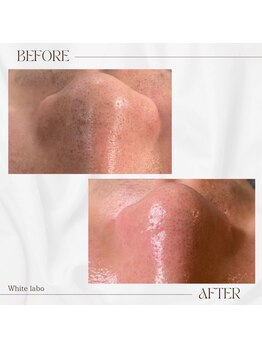 ホワイトラボ 梅田(White labo)/韓国ツヤ美肌☆オルチャン肌に♪