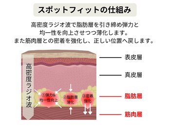 ルディラ 新宿店/スポットフィット