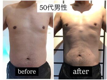 リメイクボディ センダイ(Re.Make Body SENDAI)/男性痩身もお任せください!