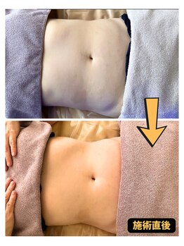 チェイン オブ フラワー(Chain Of Flower)/【RADIOシェイパー】1回での変化