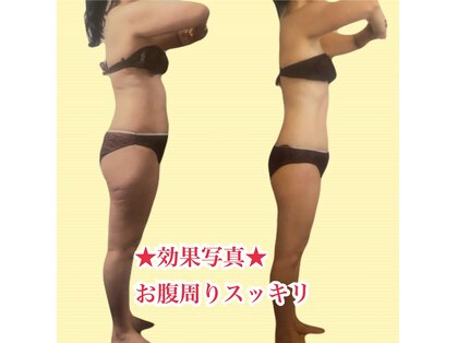 ロズアスールの写真