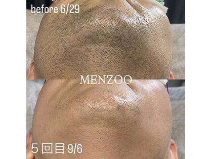 メンズー(MENZOO)の写真