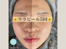 イーラボ 池袋店(e-LABO)の雰囲気（ララピール♪韓国肌管理でハリ艶肌【池袋/ピーリング/毛穴洗浄】）