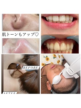 サリエ(s'allier)/