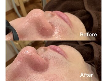 ワイイーサロン(Y/E SALON)/【初回3300円～】