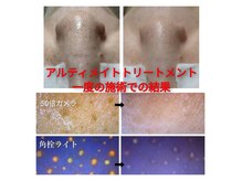 ポアレスサロン フィル(fil)