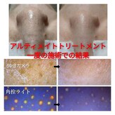 ポアレスサロン フィル(fil)